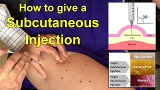 How to Give a Subcutaneous Injection Video [upl. by Asirap]