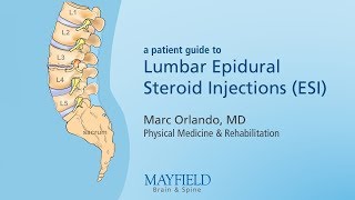 Lumbar Epidural Steroid Injections [upl. by Adiela]