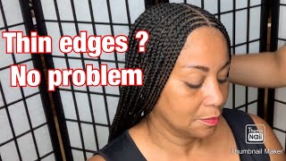 Braid style  COVER AND PROTECT THINNING EDGES [upl. by Dobson282]