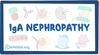 IgA nephropathy  causes symptoms diagnosis treatment pathology [upl. by Adelaja]