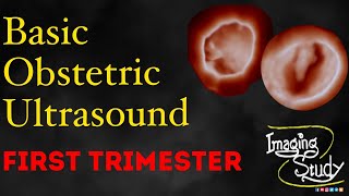 Basic Obstetric Ultrasound First Trimester Pregnancy [upl. by Airol]