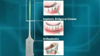 GUM SoftPicks  English [upl. by Christmas]