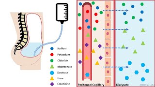 Peritoneal Dialysis [upl. by Willa729]