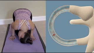 Half Somersault Maneuver to Treat BPPV Vertigo [upl. by Goldia]