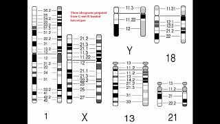 Cytogenetics II Chromosome Analysis amp Karyotypes [upl. by Bunns700]