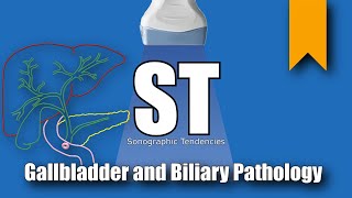 Gallbladder and Biliary Pathology [upl. by Neeruam963]