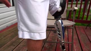 AmputeeOT How An Above Knee AK Prosthetic Leg Works [upl. by Caria875]