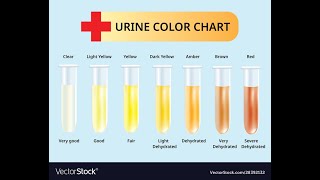 Urinalysis [upl. by Marice]