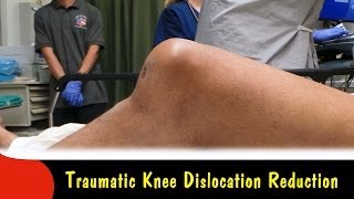 dislocated knee or patella [upl. by Drandell]