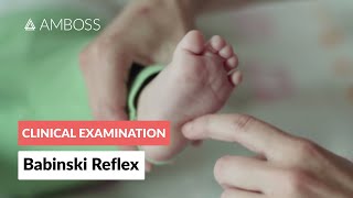 Babinski Reflex in Infants  Clinical Examination [upl. by Drawd]