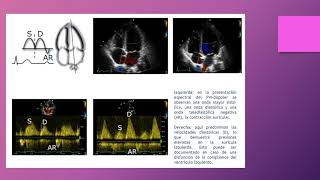 Ecocardiograma modo Doppler [upl. by Werna]