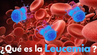 Leucemia Mieloide Aguda  Cáncer de la Sangre [upl. by Egidius]