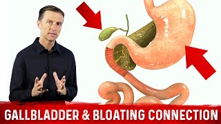 Gallbladder amp Bloating Connection Part 1 – DrBerg Bloated Stomach amp Gallbladder Function [upl. by Iblehs]