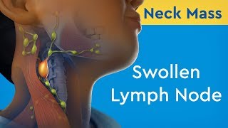 Axillary Lymph Nodes Dr Adel Bondok [upl. by Seraphina]