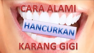 Cara Alami HANCURKAN Karang Gigi [upl. by Morena762]