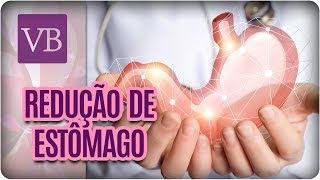 Tipos de Redução de Estômago  Você Bonita 220817 [upl. by Kessler]