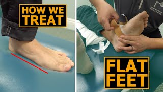 How We Treat Flat Feet  Collapsed Arches  Physical Therapy [upl. by Arrak]