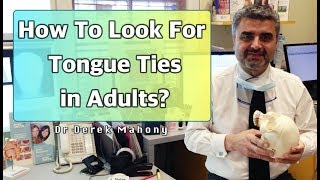 How To Look For Tongue Ties In Adults [upl. by Sueddaht]