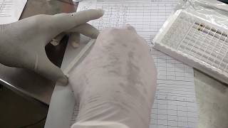 HCV ELISA test procedure [upl. by Aihsatan]