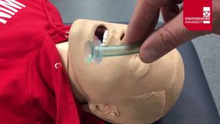 Oropharyngeal Airway Insertion [upl. by Mccarthy343]