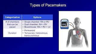 Temporary Pacemakers  Modes and Basic Settings [upl. by Hereld]