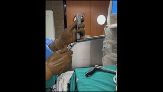 MLS microlaryngoscopy procedure [upl. by Niarfe194]