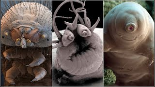 Incredible Electron Microscope Images [upl. by Nickolas984]