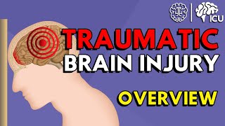 Overview of Traumatic Brain Injury TBI [upl. by Akila63]