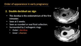 Ultrasound of normal early pregnancy [upl. by Smada]