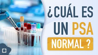 Próstata inflamada o grande ¿cual es un PSA NORMAL [upl. by Crellen311]