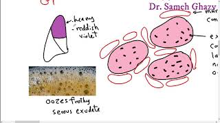 Systemic pathology 13  respiratory system 1  pneumonia and lung abscess DRSAMEH GHAZY [upl. by Noruq]