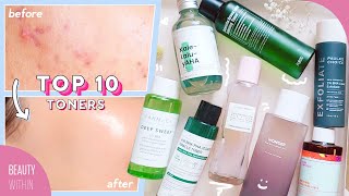 Best Toners for Acne Hyperpigmentation Large Pores Whiteheads amp Blackheads [upl. by Ode]