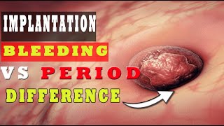 Implantation Bleeding Vs Period – How to Know the Difference 🩸🩸 [upl. by Lonny538]