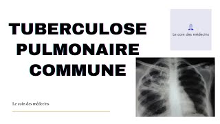 TUBERCULOSE PULMONAIRE COMMUNE [upl. by Eerolam]