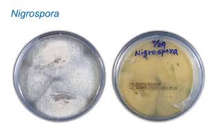 Identification of Melanized Dermatitiaceous Fungi Part 1 Hot Topic [upl. by Terris]