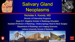 Salivary Gland Neoplasms [upl. by Jerrome]