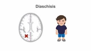 Assessment and Treatment of Stroke [upl. by Bigelow377]