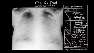 Gaz du sang en 7 étapes  Approche systématique  Partie 2  Docteur Synapse [upl. by Eel873]