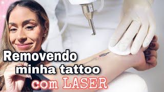 Minha REMOÇÃO de TATUAGEM à laser  TUDO o que você PRECISA SABER [upl. by Boj]