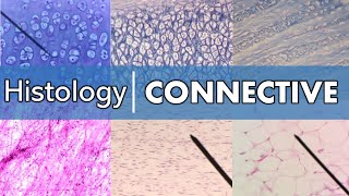 Histology  Connective Tissue [upl. by Rik]