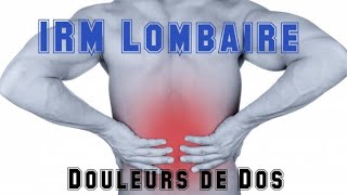 IRM DU RACHIS LOMBAIRE  Lombalgies [upl. by Cozza701]