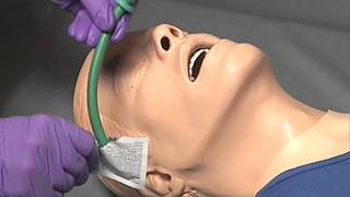 Nasopharyngeal Airway NPA Insertion [upl. by Lihp347]