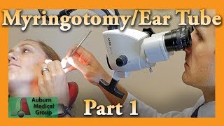 Myringotomy amp Ear Tube Part 1 Feat Dr Tim Fife  Myringotomy  Auburn Medical Group [upl. by Inittirb]