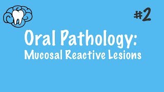 Oral Pathology  Mucosal Reactive Lesions  INBDE ADAT [upl. by Ilyk]