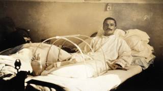 Infections  WW1 Uncut  BBC [upl. by Barnabe]