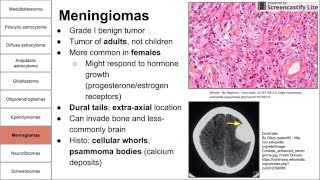 Nervous System Tumors [upl. by Alol]