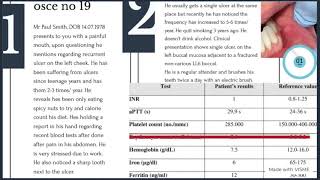 osce 19 dental clinical exams part 2 ORE MFDS MJDF LDS UK spoken [upl. by Eetak685]